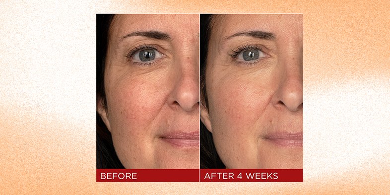 In Article Skin Brightening Tips RevitaLift Triple Power Anti Aging Moisturizer